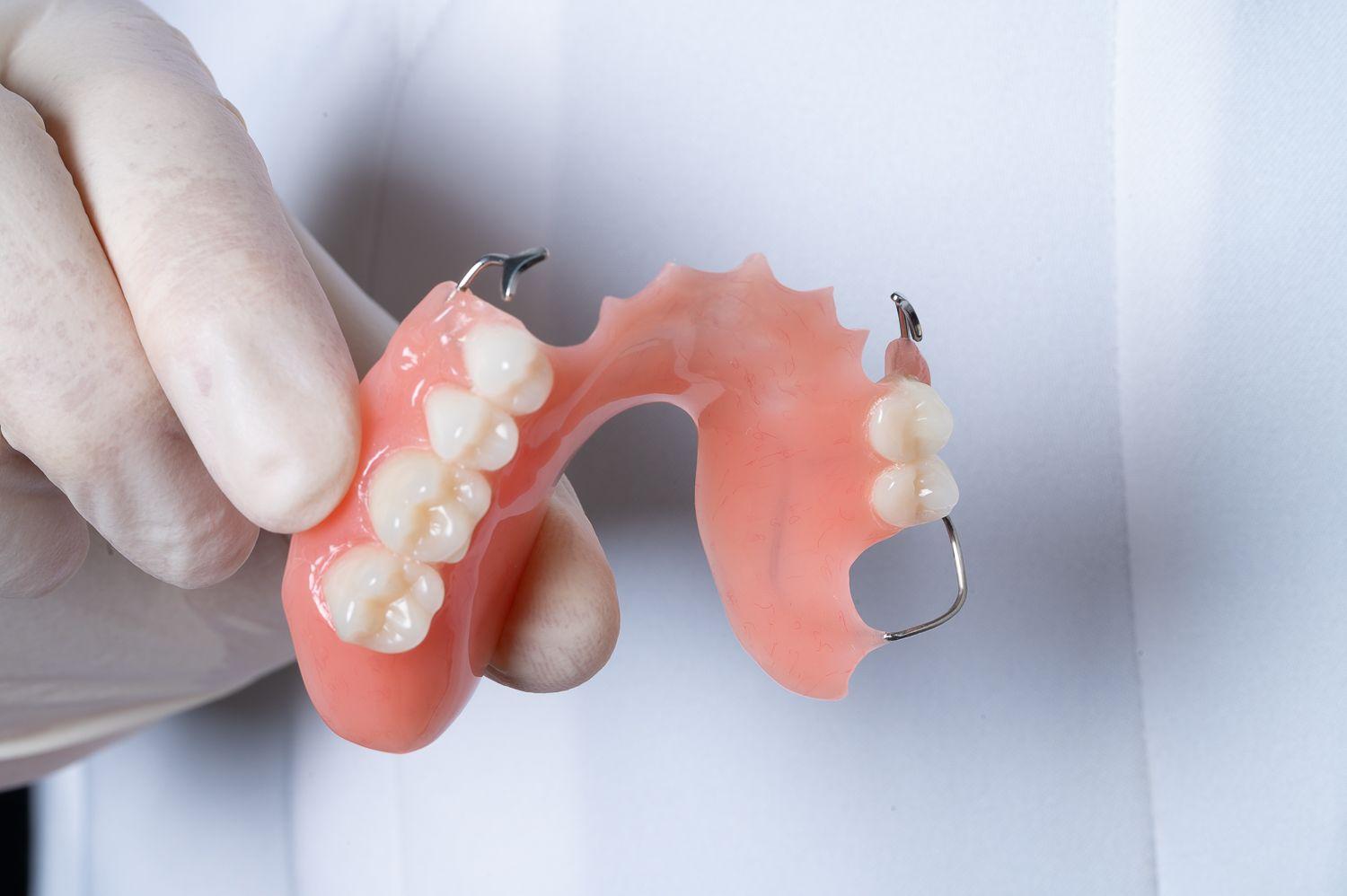 Съемный протез зубов какие бывают. Нейлоновый микропротез 1-3 зуба. Съемный пластинчатый протез (1 пластина). Съемный протез (6-14 зубов) термо Джет.